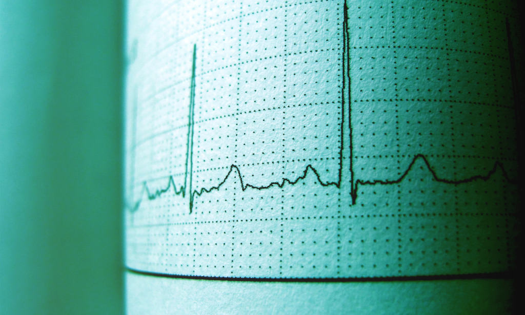 Heart Rate Variability Can Reflect Changing Physiological State